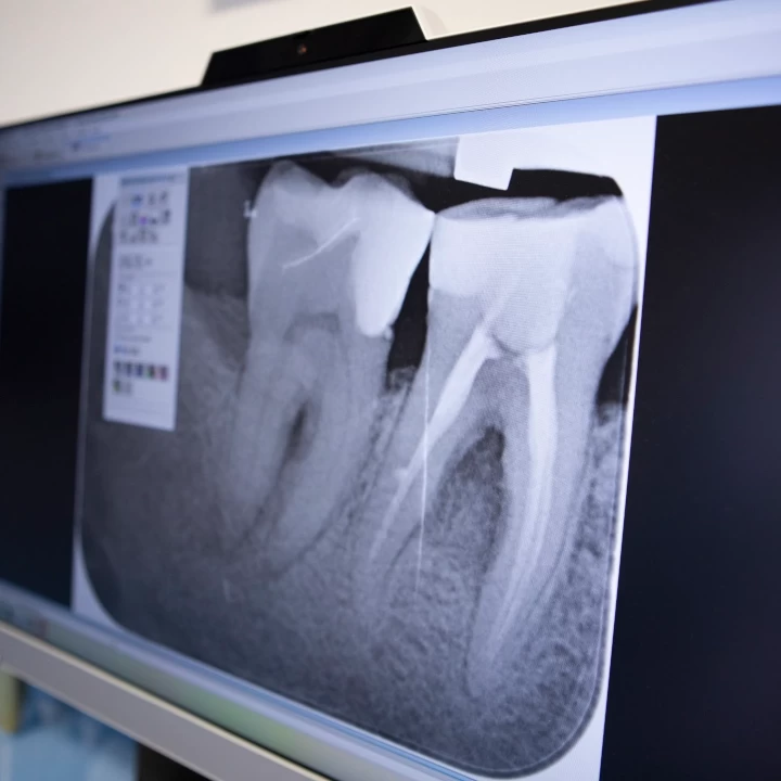 dentista chiaravalle